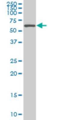 Western Blot: AATF Antibody (3C7) [H00026574-M04]