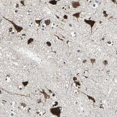 Immunohistochemistry-Paraffin: AATF Antibody [NBP1-85634]