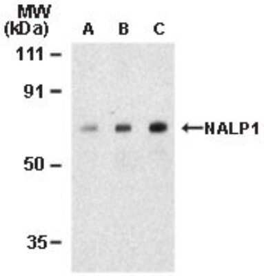 Western Blot: AATF AntibodyBSA Free [NBP1-76655]