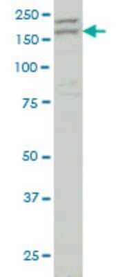 Western Blot: AATK/Serine/threonine-protein kinase LMTK1 Antibody (2C8) [H00009625-M04]