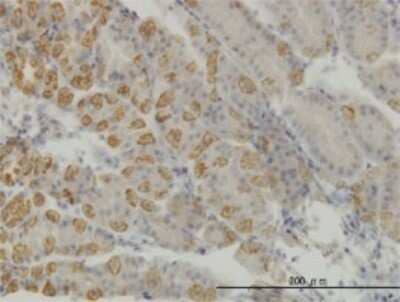 Immunohistochemistry-Paraffin: AATK/Serine/threonine-protein kinase LMTK1 Antibody (5H5) [H00009625-M01]