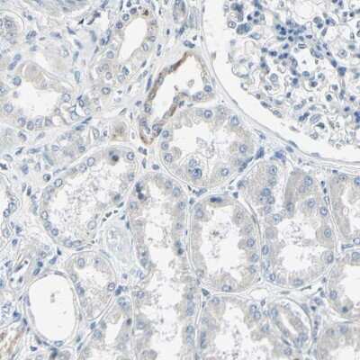 Immunohistochemistry-Paraffin: AATK/Serine/threonine-protein kinase LMTK1 Antibody [NBP1-90292]