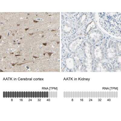 Immunohistochemistry-Paraffin: AATK/Serine/threonine-protein kinase LMTK1 Antibody [NBP1-90292]