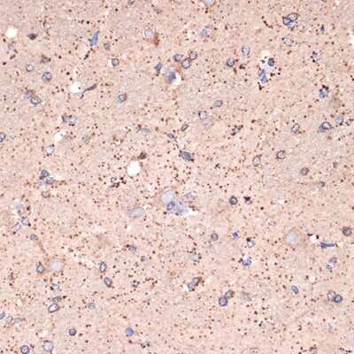 Immunohistochemistry-Paraffin: ABAT Antibody (10V1K9) [NBP3-16767]
