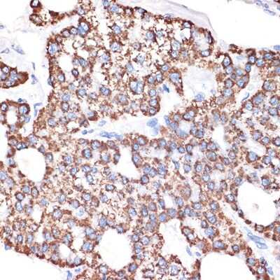 Immunohistochemistry-Paraffin: ABAT Antibody (10V1K9) [NBP3-16767]