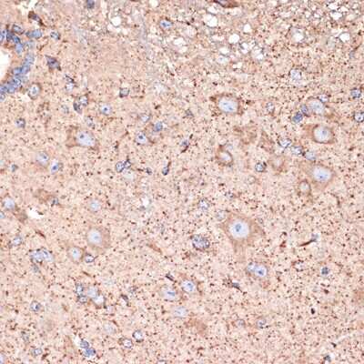 Immunohistochemistry-Paraffin: ABAT Antibody (10V1K9) [NBP3-16767]