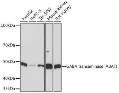 Western Blot: ABAT Antibody (10V1K9) [NBP3-16767]