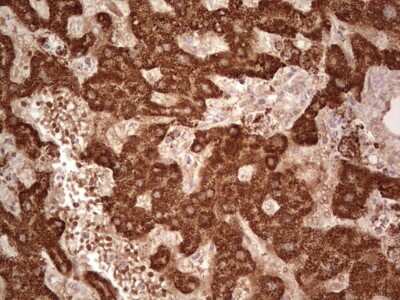 Immunohistochemistry: ABAT Antibody (OTI6C9) [NBP2-45541]