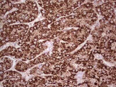 Immunohistochemistry: ABAT Antibody (OTI6C9) [NBP2-45541]