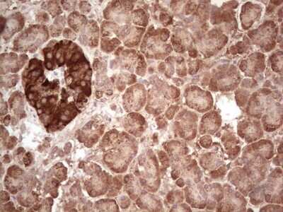 Immunohistochemistry: ABAT Antibody (OTI6C9) [NBP2-45541]