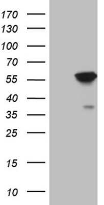 Western Blot: ABAT Antibody (OTI6C9) [NBP2-45541]