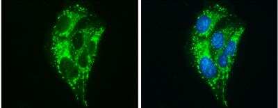 Immunocytochemistry/ Immunofluorescence: ABAT Antibody [NBP2-21598]