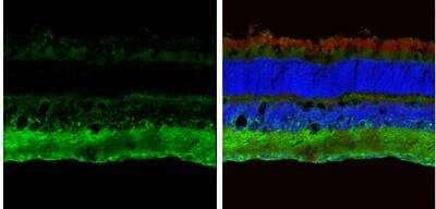 Immunohistochemistry-Frozen: ABAT Antibody [NBP2-21598]