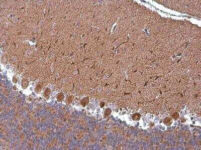 Immunohistochemistry-Paraffin: ABAT Antibody [NBP1-33066]