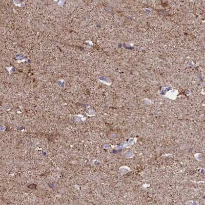 Immunohistochemistry-Paraffin: ABAT Antibody [NBP1-83400]