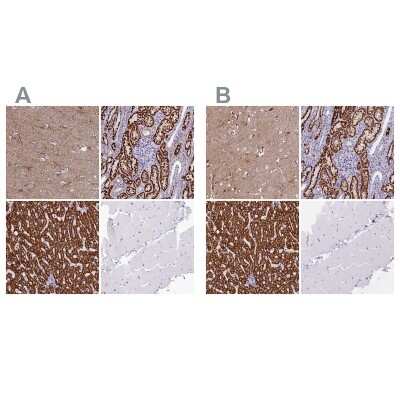 Immunohistochemistry-Paraffin: ABAT Antibody [NBP1-83400]