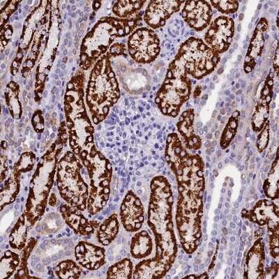 Immunohistochemistry-Paraffin: ABAT Antibody [NBP1-83400]
