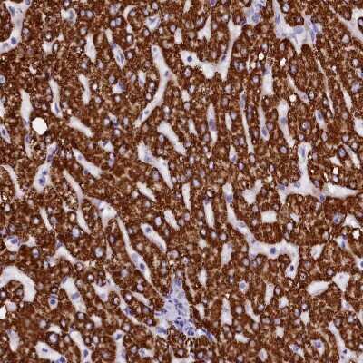 Immunohistochemistry-Paraffin: ABAT Antibody [NBP1-83400]