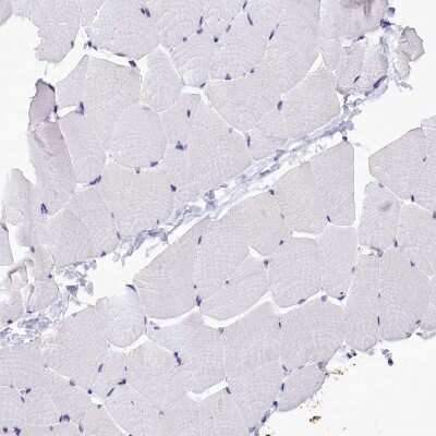 Immunohistochemistry-Paraffin: ABAT Antibody [NBP1-83400]