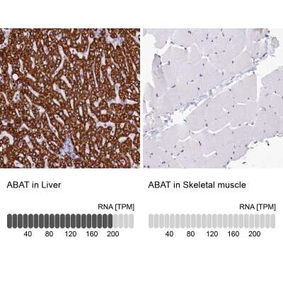Immunohistochemistry-Paraffin: ABAT Antibody [NBP1-83400]