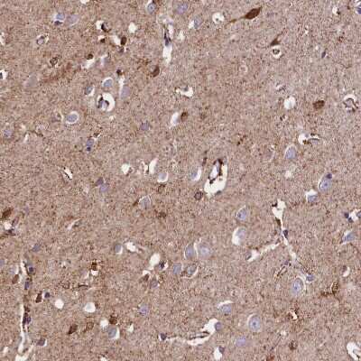 Immunohistochemistry-Paraffin: ABAT Antibody [NBP1-83401]