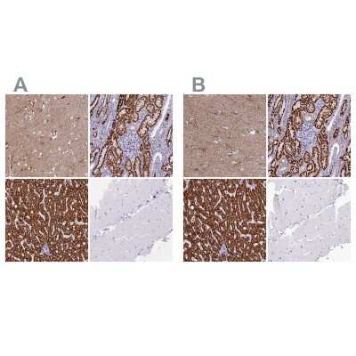 Immunohistochemistry-Paraffin: ABAT Antibody [NBP1-83401]