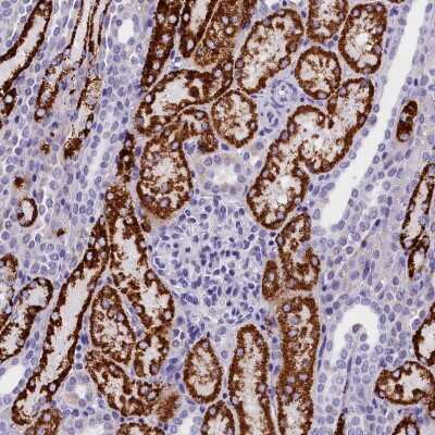 Immunohistochemistry-Paraffin: ABAT Antibody [NBP1-83401]