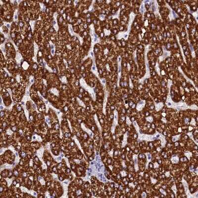Immunohistochemistry-Paraffin: ABAT Antibody [NBP1-83401]