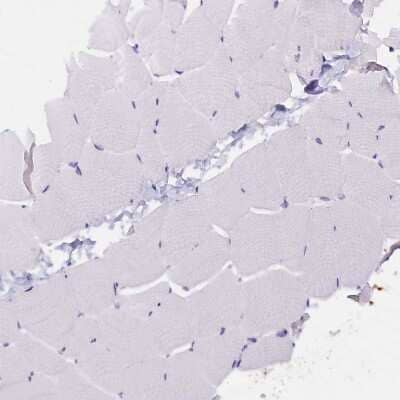 Immunohistochemistry-Paraffin: ABAT Antibody [NBP1-83401]