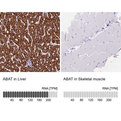 Immunohistochemistry-Paraffin: ABAT Antibody [NBP1-83401]