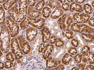 Immunohistochemistry-Paraffin: ABAT Antibody [NBP2-21598]