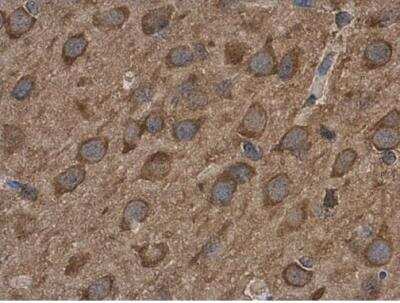 Immunohistochemistry-Paraffin: ABAT Antibody [NBP2-21598]