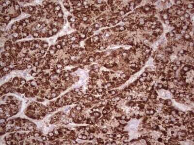 Immunohistochemistry: ABAT Antibody (OTI6C9) - Azide and BSA Free [NBP2-70060]