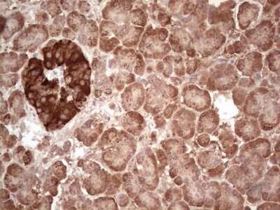 Immunohistochemistry: ABAT Antibody (OTI6C9) - Azide and BSA Free [NBP2-70060]