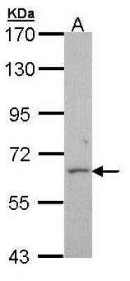 Western Blot: ABAT Antibody [NBP1-33066]