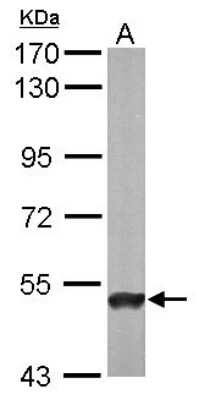 Western Blot: ABAT Antibody [NBP1-33066]