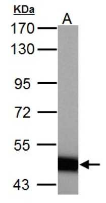 Western Blot: ABAT Antibody [NBP1-33066]