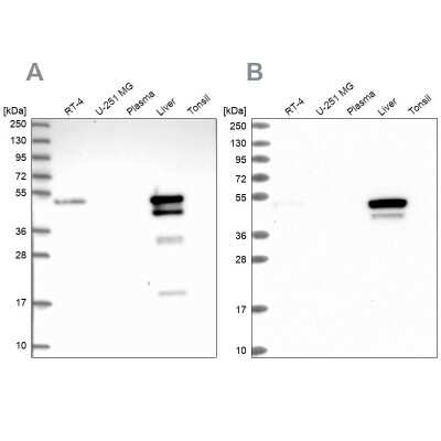 Western Blot: ABAT Antibody [NBP1-83400]