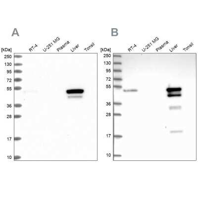 Western Blot: ABAT Antibody [NBP1-83401]