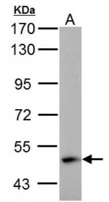 Western Blot: ABAT Antibody [NBP2-21598]