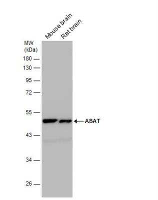 Western Blot: ABAT Antibody [NBP2-21598]