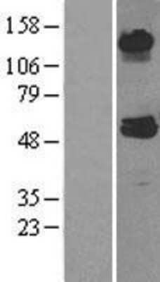 Western Blot: ABAT Overexpression Lysate [NBL1-07169]