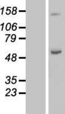 Western Blot: ABAT Overexpression Lysate [NBL1-07170]