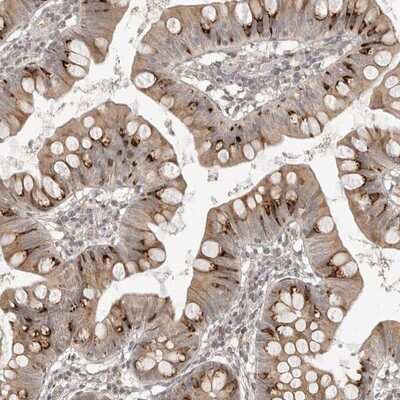 Immunohistochemistry-Paraffin: ABC2 Antibody [NBP1-87918]