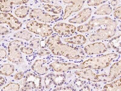 Immunohistochemistry-Paraffin: ABC2 Antibody [NBP2-98086]