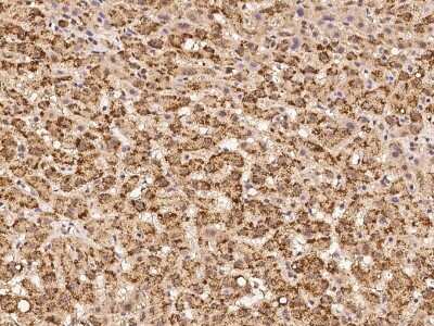 Immunohistochemistry-Paraffin: ABC2 Antibody [NBP2-98086]