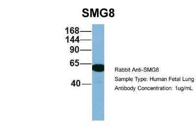 Western Blot: ABC2 Antibody [NBP1-56876]