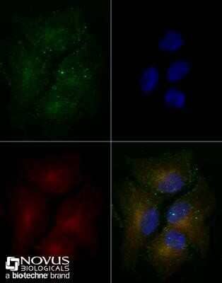 Immunocytochemistry/ Immunofluorescence: ABCA1 Antibody (1276B) - Azide and BSA Free [NBP2-80556]