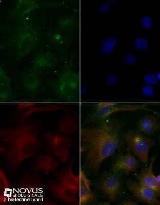 Immunocytochemistry/ Immunofluorescence: ABCA1 Antibody (1276B) - Azide and BSA Free [NBP2-80556]