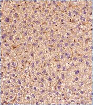 Immunohistochemistry-Paraffin: ABCA1 Antibody (1276B) - Azide and BSA Free [NBP2-80556]